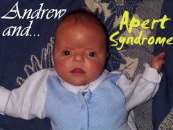 Baby Adoo